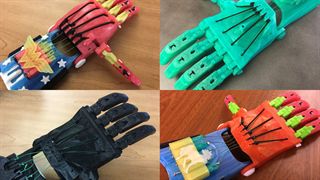 Crown Point 3D printed prosthetics